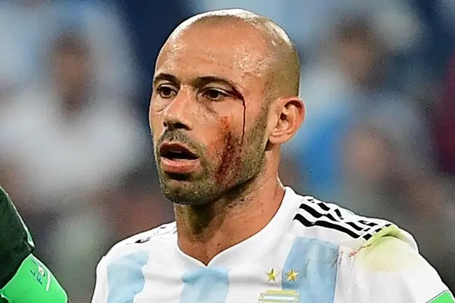 mascherano nigeria 9tqs41lzawpw10g96hv0wsfwv 1638 684d18e40dbc2