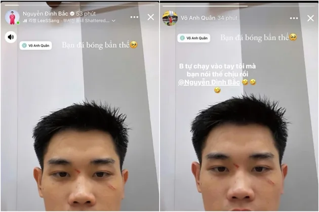 Đình Bắc phản hồi sau khi cáo buộc đồng đội U23 Việt Nam ‘chơi xấu’